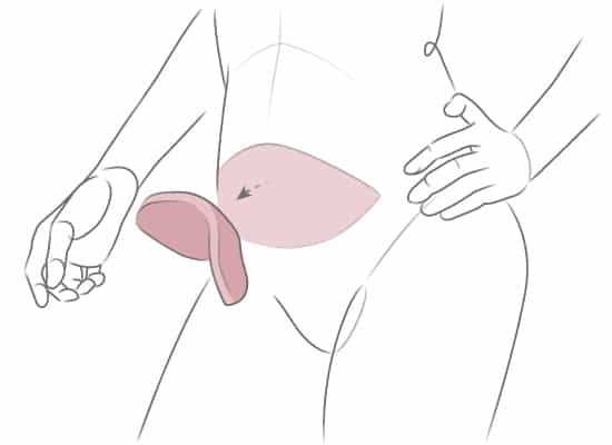 Abdominal Results Patients Can Expect After DIEP Flap Breast